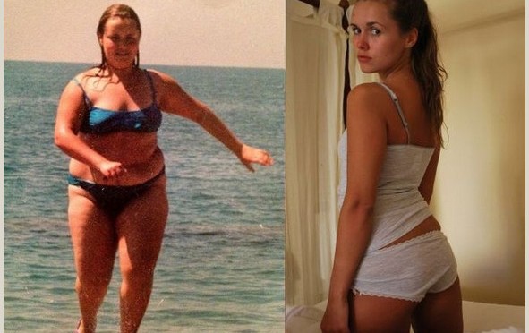 14歳で105キロあったロシアの少女が2年で50キロのダイエットに成功し 現在19歳で体重51キロの美少女に