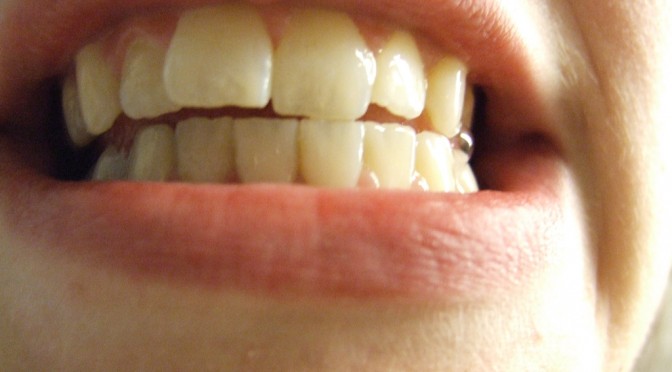 マツコ・デラックスさん、年末年始は「歯ぐきの移植手術」