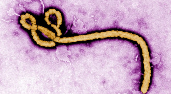 西アフリカで起きたエボラ出血熱 ＷＨＯが終息宣言