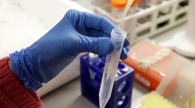 すい臓がんを血液検査で早期発見する方法を開発　RNAに着目｜東大