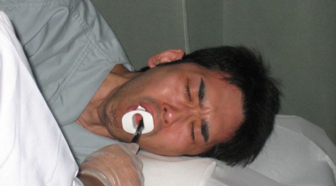 胃カメラ鼻挿入、高齢者には負担大　新大江病院研究　米学会で高評価