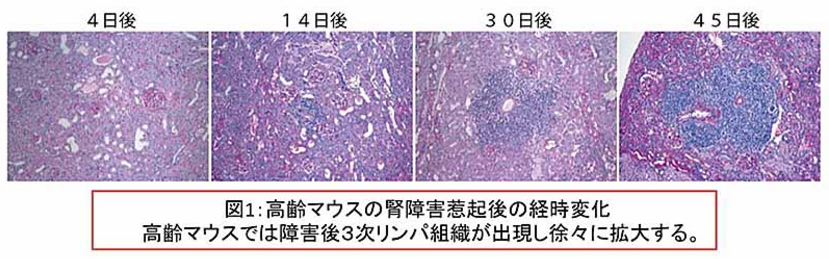 高齢マウスの腎障害惹起後の経時変化｜高齢マウスでは障害後3次リンパ組織が出現し徐々に拡大する。