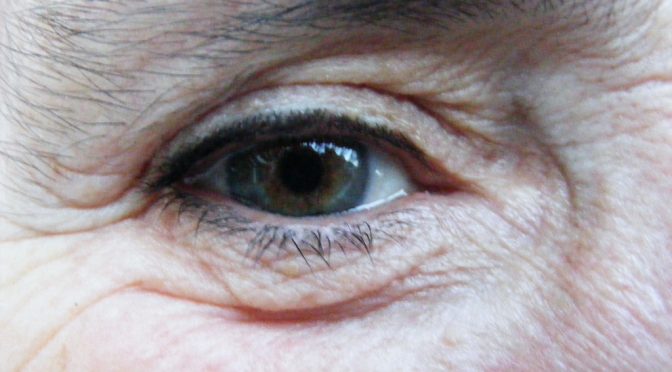 緑内障は目のアルツハイマー病？｜「ベータアミロイド」が緑内障の重要な発症原因でもある