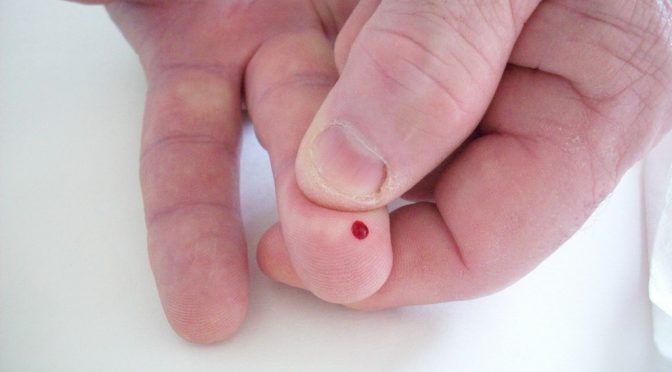 指先から血液１滴を採取するだけで血栓リスクを測定できる装置｜血液凝固能の指標であるプロトロンビン時間（PT-INR検査）を測定