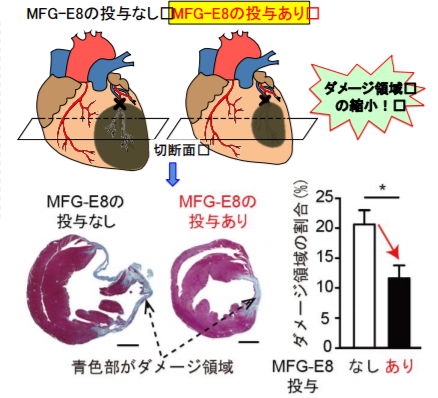 心筋梗塞後の病態を改善するタンパク質「MFG-E8」発見　新たな心筋梗塞の治療法の可能性