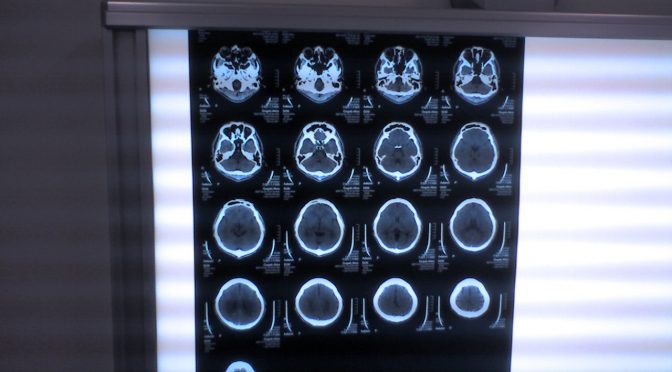 肝臓がんの画像診断を人工知能（機械学習）で支援する「類似多時相CT画像検索システム」を開発｜立命館大学