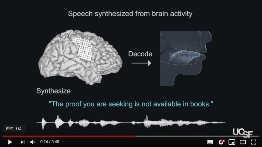 Speech synthesis from neural decoding of spoken sentences